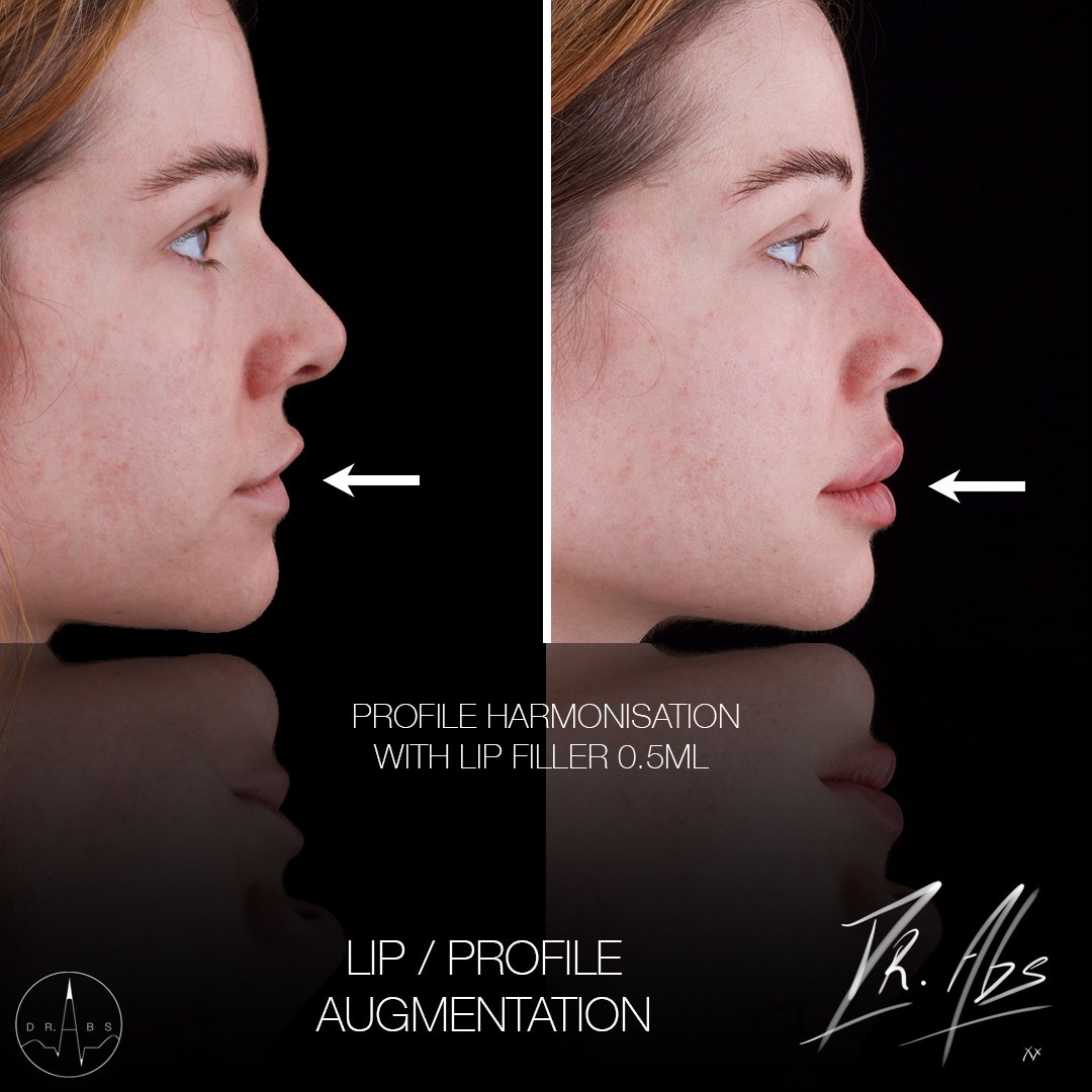Before and after, case 6