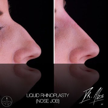 Before and after, case 7