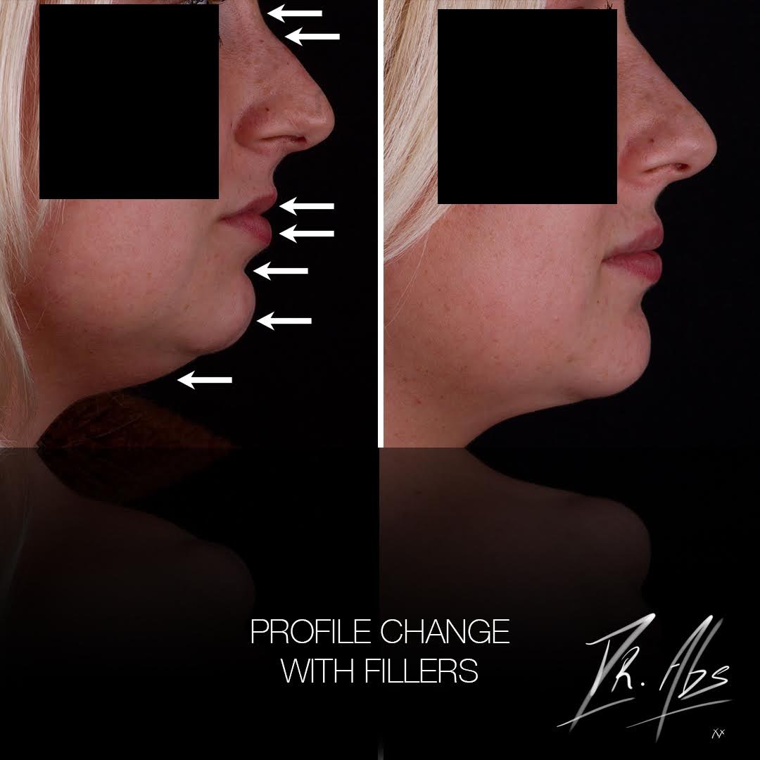 Before and after, case 8
