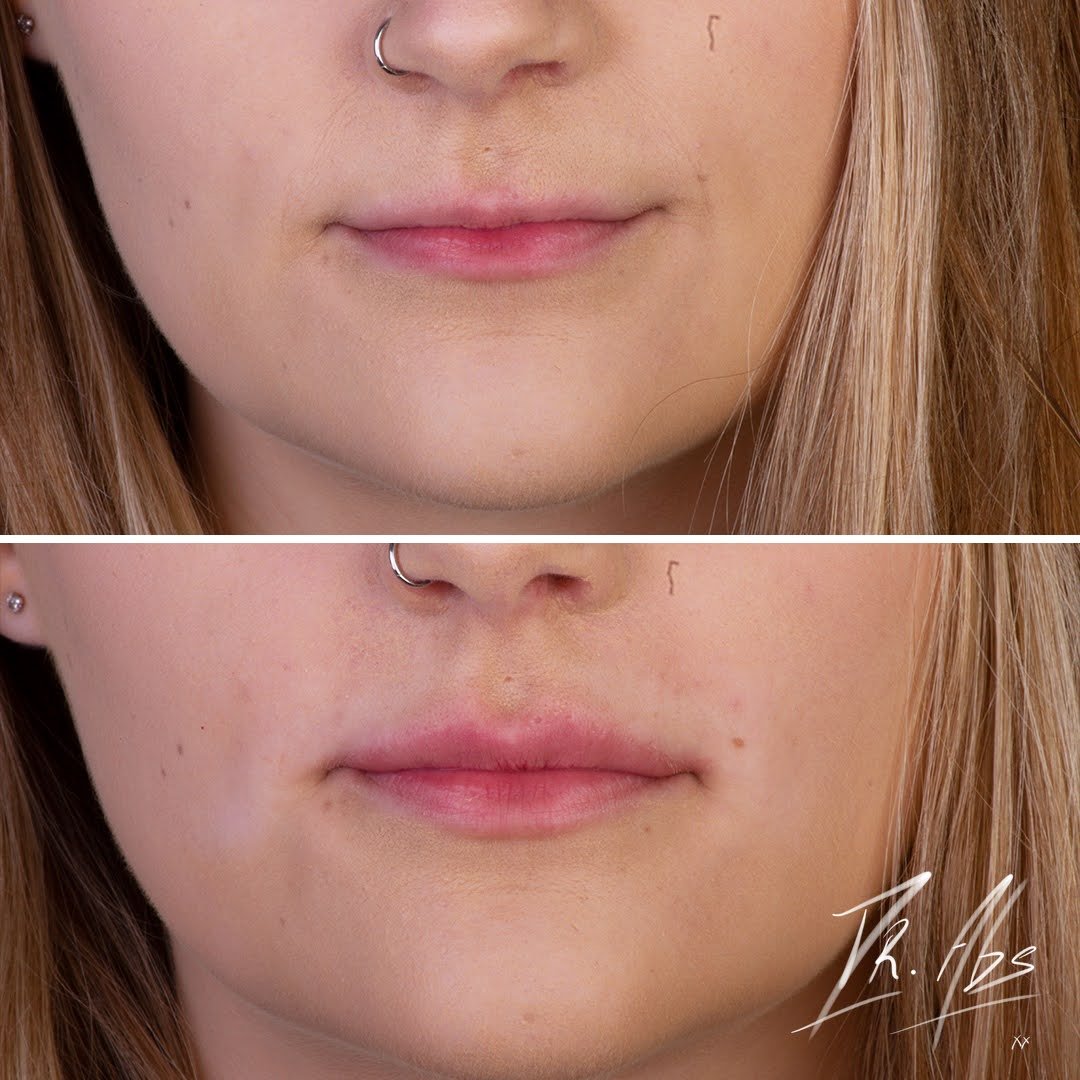 Before and after, case 10