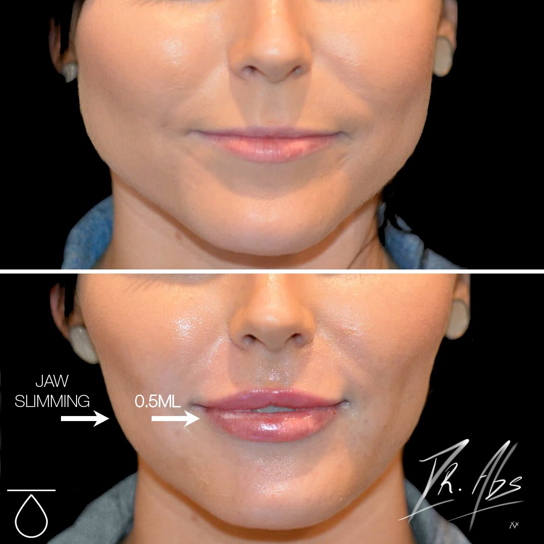 Before and after, case 12