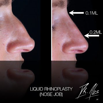 Before and after, case 13