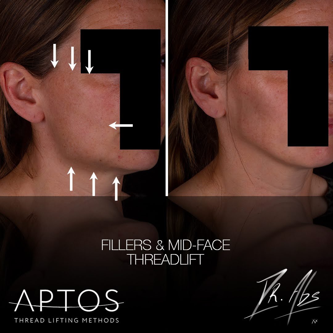 Before and after, case 16