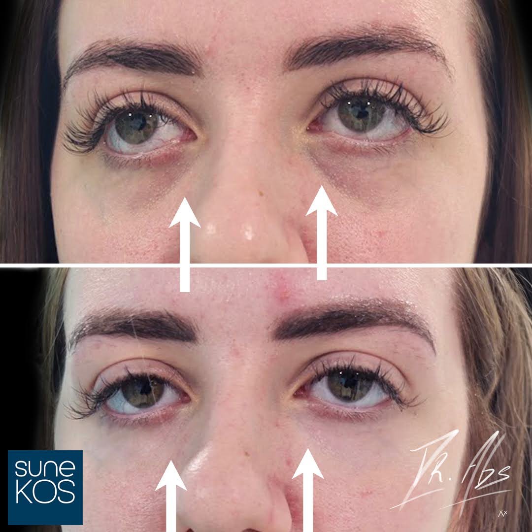 Before and after, case 18